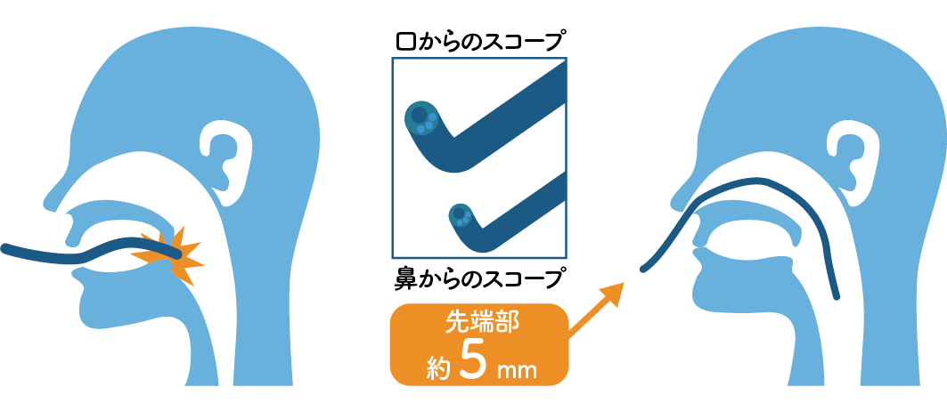 それでも検査が不安な方へ